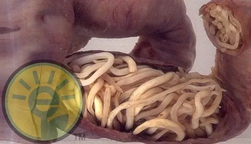 Toxofil отзиви, в аптеките, България, състав, производител, цена, къде да купя.